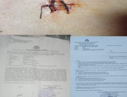 *Masyarakat Empat Lawang Mengeluh, diduga Laporan Tidak ditangani Dengan Serius*